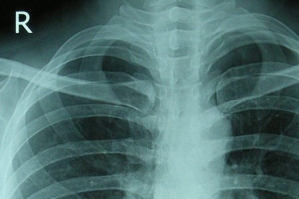 Радиология, КВН, кровавая баня, пианист и землетрясения. День в истории