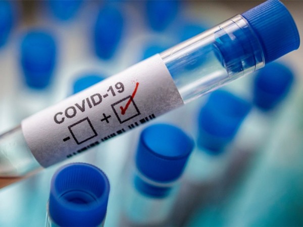 Контактных с covid-пациентами оренбуржцев обязали сидеть дома