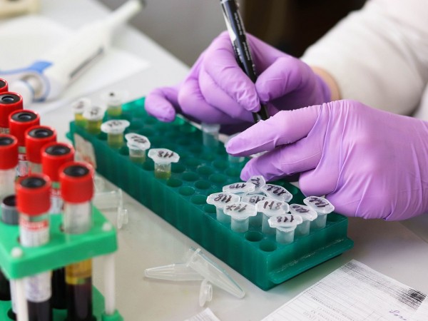 В Оренбуржье плюс 3 смерти от коронавируса