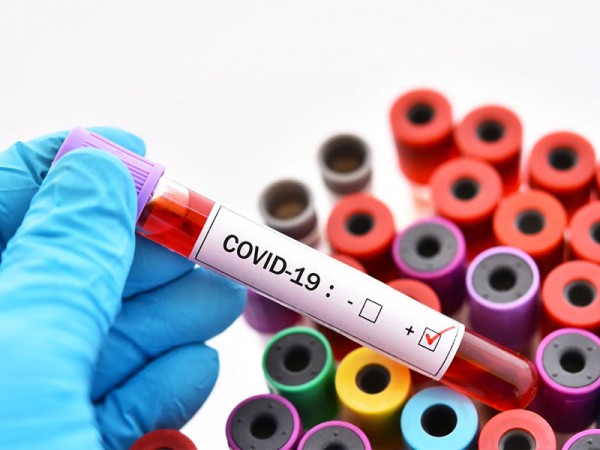 Иммунитет от COVID-19 после болезни и вакцинации не отличается