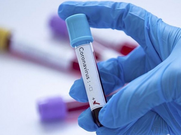 В Оренбуржье от COVID-19 скончались 320 человек с начала пандемии