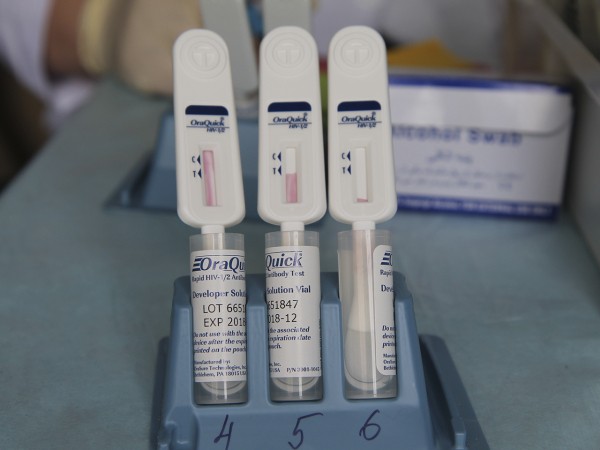 Оренбуржцев бесплатно протестируют на ВИЧ Оренбуржцев бесплатно протестируют на ВИЧ