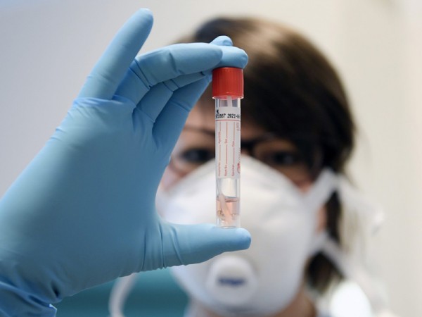 В Оренбуржье от коронавируса умерли 587 человек