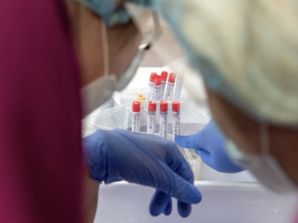 От коронавируса в Оренбуржье умерли еще пять человек