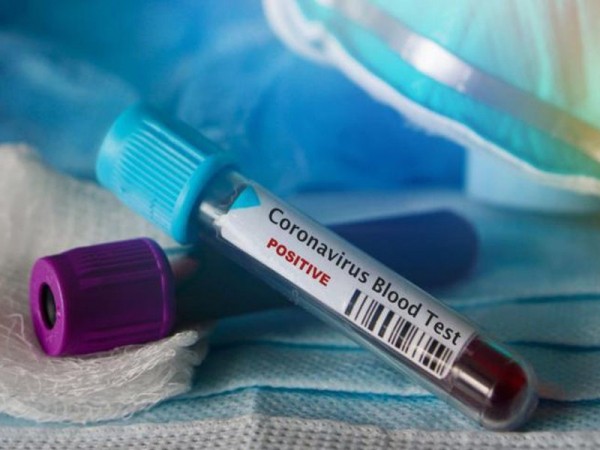 В Оренбургской области стало известно о еще двух смертях от COVID-19