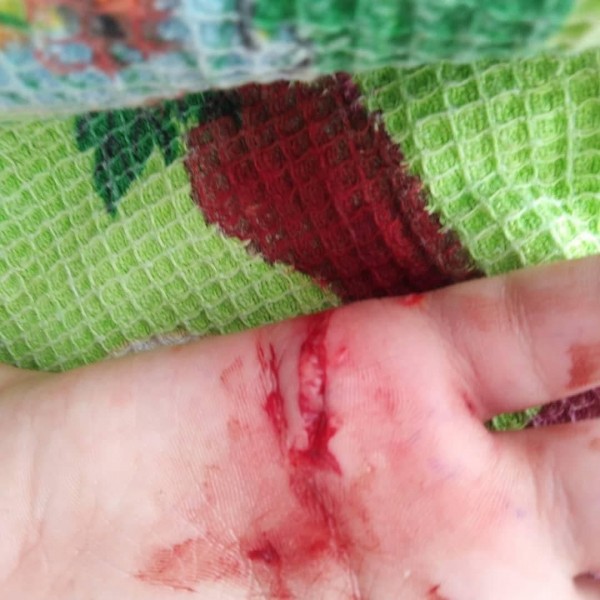 В Оренбурге за покусанную бездомными собаками девочку ответит администрация