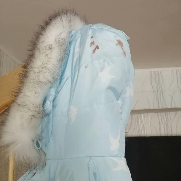 В Оренбурге за покусанную бездомными собаками девочку ответит администрация