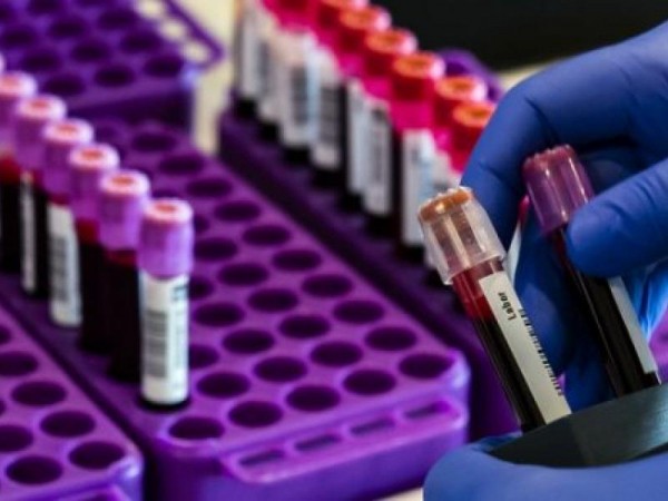 Случаи мутации коронавируса зафиксированы в Акбулакском и Первомайском районах Оренбуржья Случаи мутации коронавируса зафиксированы в Акбулакском и Первомайском районах Оренбуржья