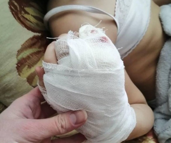 В Оренбурге за покусанную бездомными собаками девочку ответит администрация