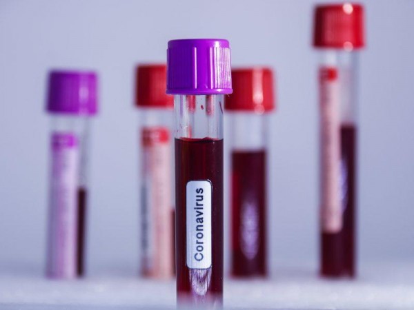 В Оренбуржье от коронавируса умерли еще 5 человек