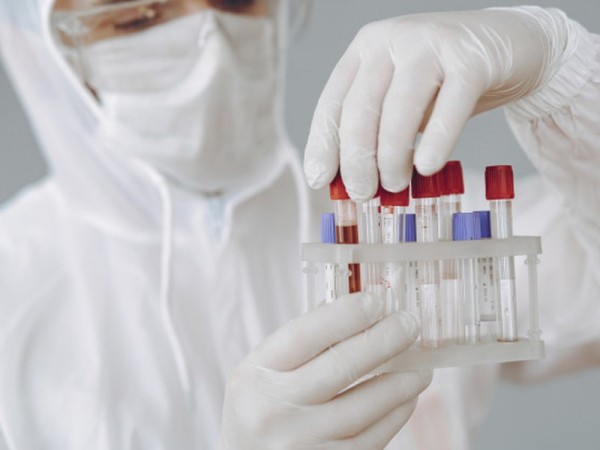 Коронавирус в Оренбуржье унес жизни еще троих человек Коронавирус в Оренбуржье унес жизни еще троих человек