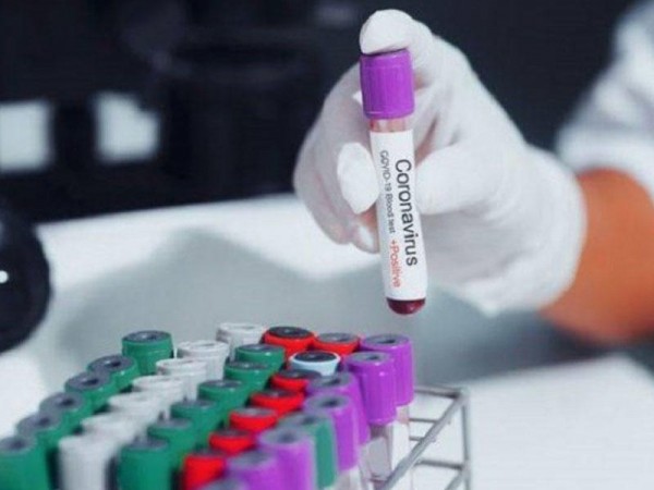 От короновируса скончались еще 5 оренбуржцев От короновируса скончались еще 5 оренбуржцев