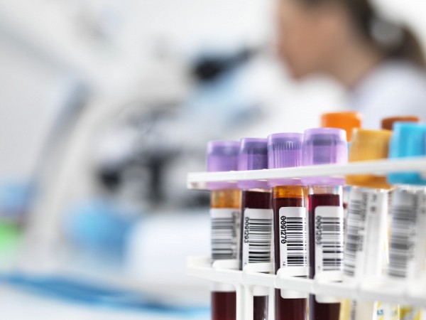 От коронавируса умерли 878 жителей Оренбуржья