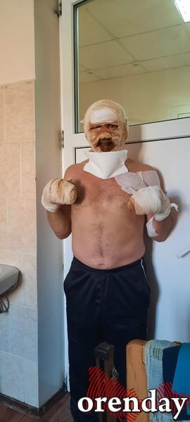 Что сейчас с оренбургским пенсионером, который чуть не погиб у Дома Советов