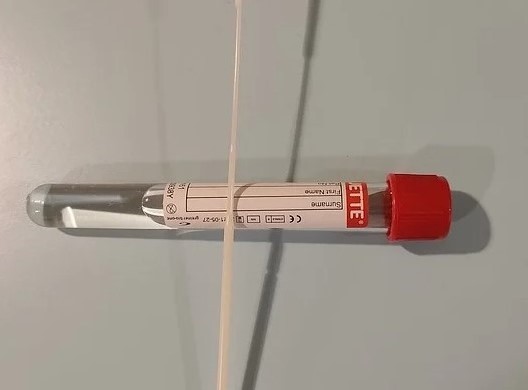 В Оренбуржье детей в лагеря теперь принимают только с ПЦР-тестами