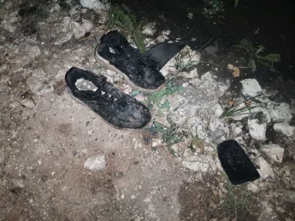 Ребенок, получивший во время пожара в Шарлыке ожоги, скончался (18+)